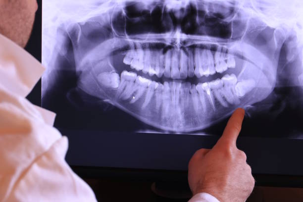 Best Walk-In Emergency Dental Services in Berwyn, IL